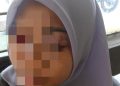 Wajah Ibu Muda di Takalar Babak Belur Dibogem Suami, Pihak Keluarga Lapor Polisi Minta Pelaku Ditahan