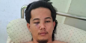 WMI Kecam Pengeroyokan Puluhan Oknum Polisi terhadap aktifisnya di Mamuju – Sulawesi Barat