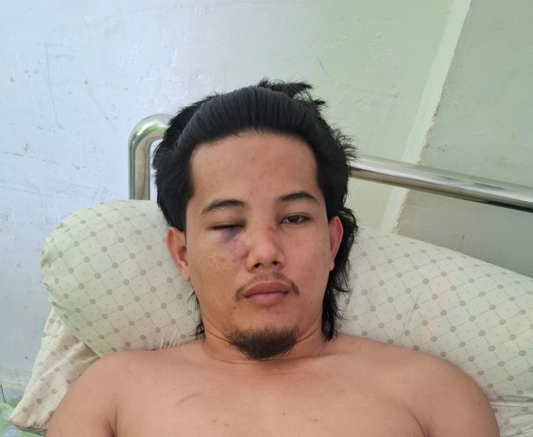 WMI Kecam Pengeroyokan Puluhan Oknum Polisi terhadap aktifisnya di Mamuju – Sulawesi Barat
